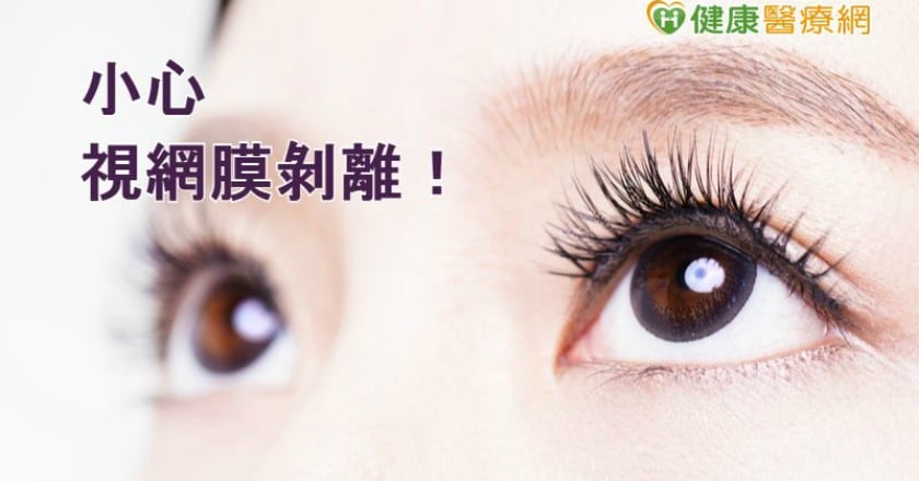 視網膜剝離有徵兆 醫:有症狀速就醫