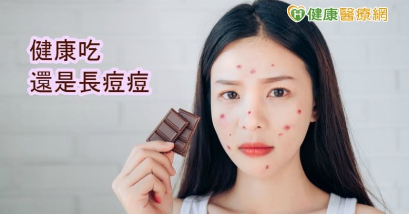 飲食與青春痘有關嗎? 醫:因人而異