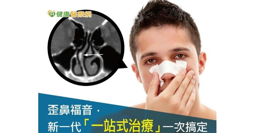 歪鼻福音　新一代一站式治療一次搞定