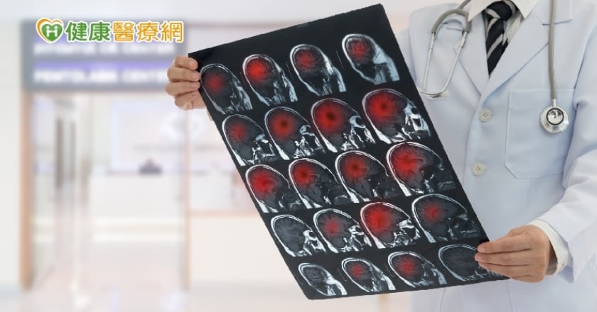 龍巖總裁李世聰病逝享壽65歲　凸顯腦瘤危險性！
