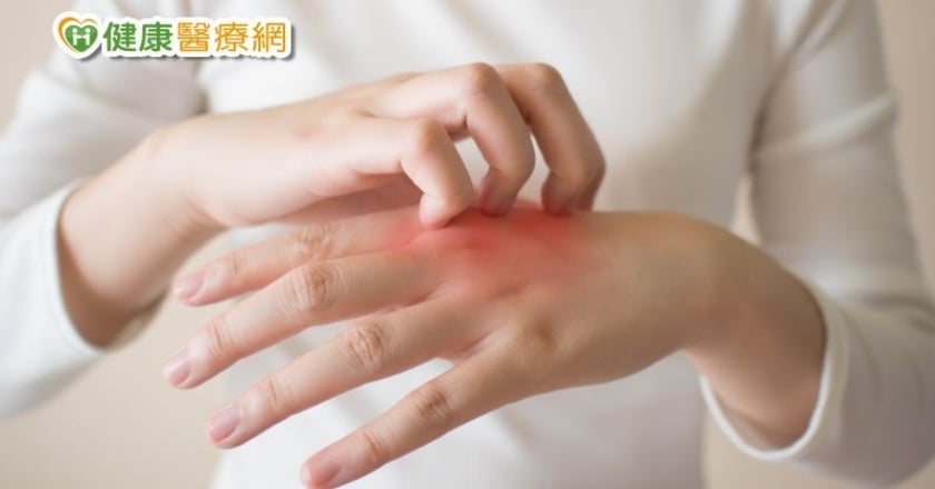 治療新知！棘手「結節性癢疹」不再沒藥醫　FDA核准第1個治療藥