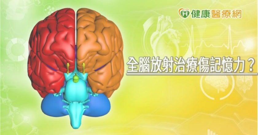 全腦放射治療傷記憶力? 醫師解析腦轉移保存記憶治療方式