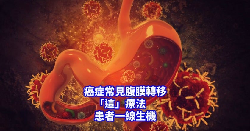 癌細胞怕熱? 這項「殺手鐧」讓癌末現生機