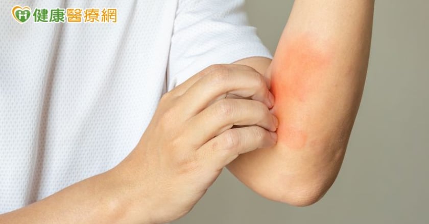抗生素引發史帝文強生症候群 研究：患自體免疫疾病風險增5.6倍
