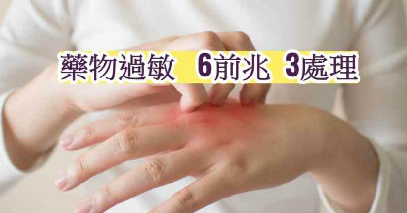 不可不知！　藥物過敏6前兆、3處理原則