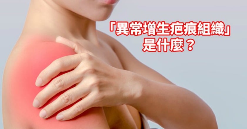 為何「疤著我不放」? 蟹足腫好發這四個部位