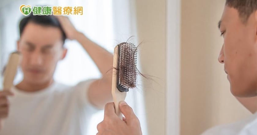 有「雄性禿」該怎麼辦?醫師帶你一次看4種治療法