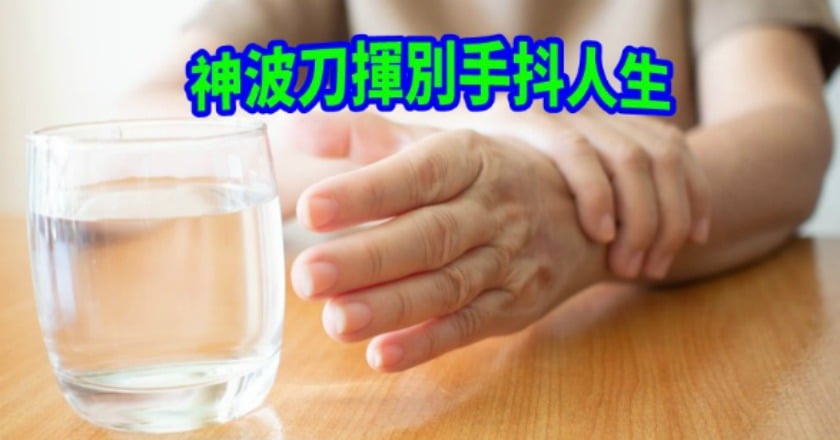 神波刀治療顫抖症　揮別手抖人生