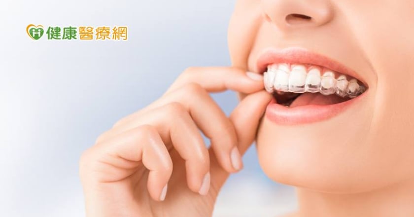 齒列不正恐歪臉 牙醫傳授如何挑選適合的矯正方式