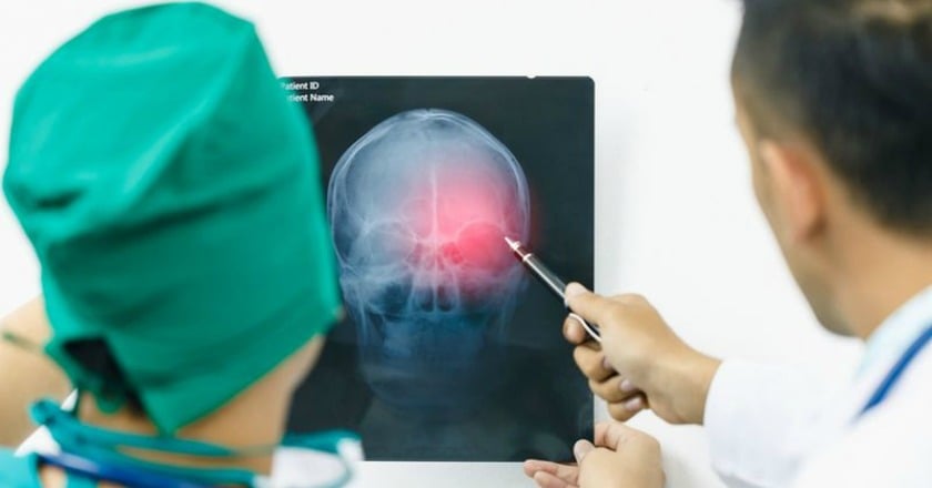 腦瘤發生原因不明　有這些症狀要留意