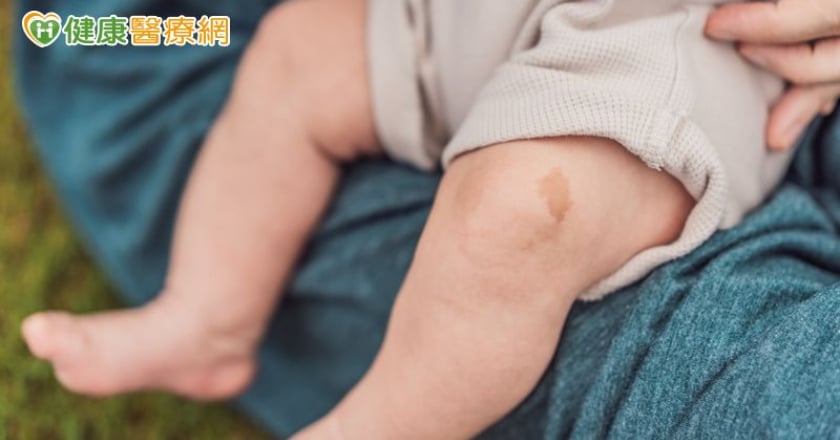 出生異常複雜「血管瘤」 11歲女童恢復行動、融入同儕