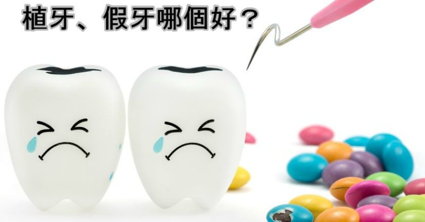 蛀牙被拔牙後怎辦？　醫師分析假牙和植牙