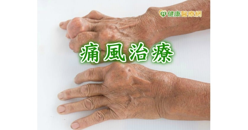 不同痛風階段　治療方式大不同