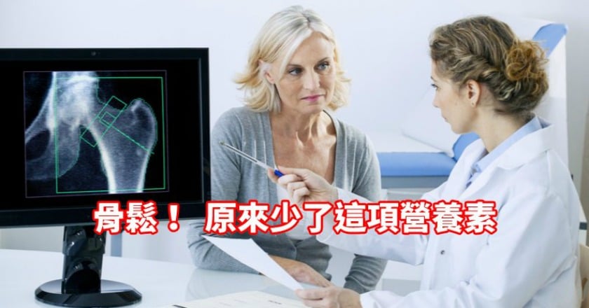 骨鬆比老媽更嚴重！　原來跟少了這項營養素有關