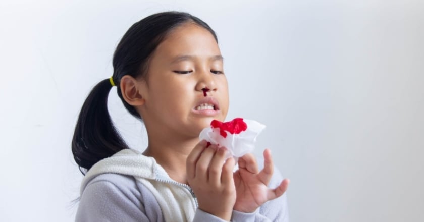 流鼻血「頭往後仰」是錯的! 4種狀況應帶孩子就醫