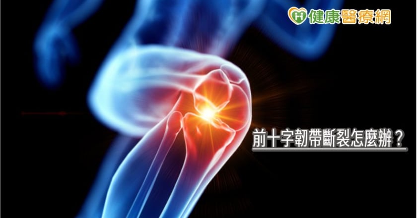 前十字韌帶斷裂怎麼辦？　微創手術助復原、減少併發症