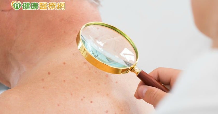 手肘摸到不明硬塊　竟罹患罕見皮膚癌「默克細胞癌」