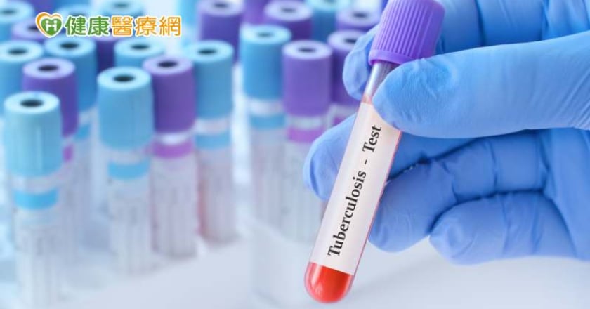 預防結核病從篩檢、治療做起! 完成LTBI檢驗、治療還有機會抽大獎