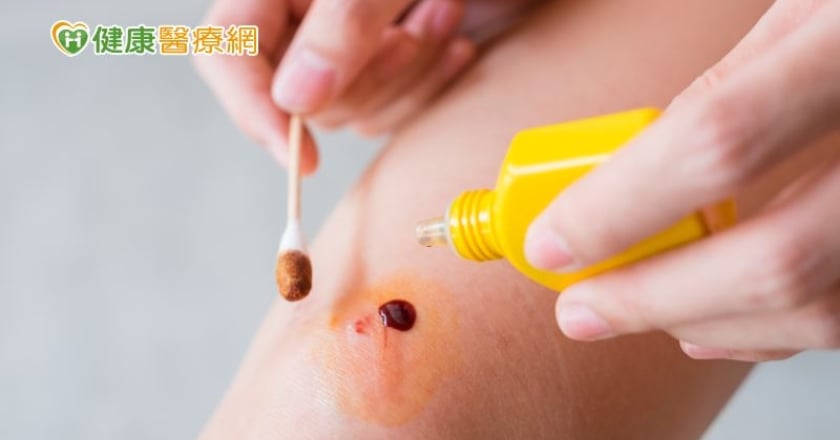 常見6傷口消毒藥水全解析! 優碘、雙氧水、白藥水、黃藥水你用對了嗎?
