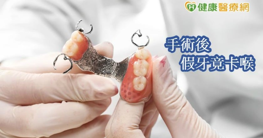 手術後假牙卡喉嚨8天 英男子咳血求醫