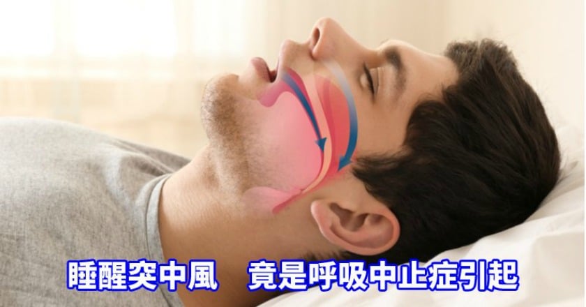 46歲男睡醒突中風 竟是「這病」引起的