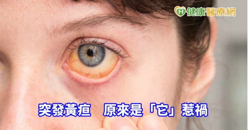 七旬婦人突發黃疸 原來是「它」惹禍