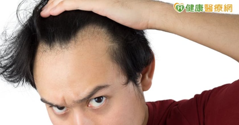 35歲男髮際線後退「M型禿」!中醫「1治療」改善掉髮、新髮冒出