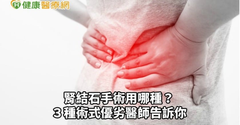 腎結石手術用哪種？　３種術式優劣醫師告訴你