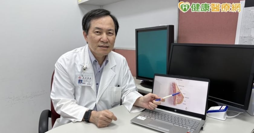 不想HER2乳癌復發轉移 「強化輔助治療」降3成風險